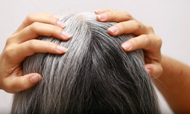 wellhealthorganic.com/know-the-causes-of-white-hair-and-easy-ways-to-prevent-it-naturally